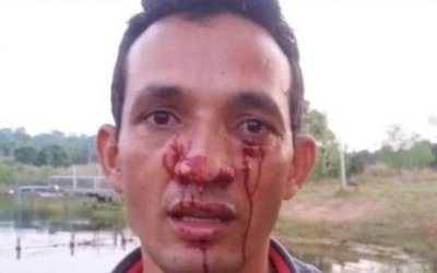 Empresário é atacado no rosto por sucuri de 3 metros durante pescaria