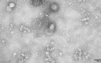 Casos de coronavírus na Venezuela sobem para 42