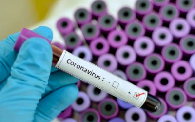 Brasil registra 177.589 casos de coronavírus e 72.597 pessoas recuperadas