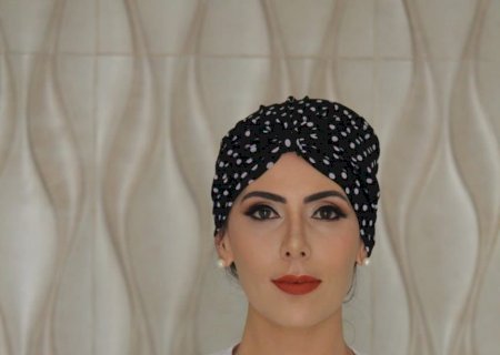 Alopecia: Conheça sobre a condição que afeta a atriz e esposa de Will Smith, Jada Pinkett