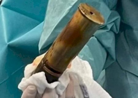 Homem faz hospital ser evacuado ao chegar no local com bomba no ânus.