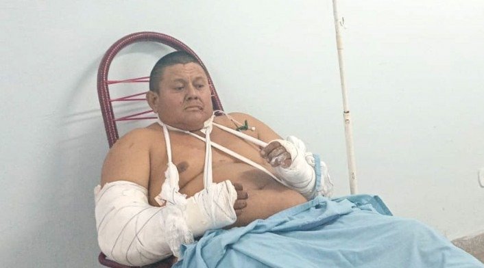 “É um presente de aniversário estar aqui”, diz trabalhador que sofreu ataque de onça.