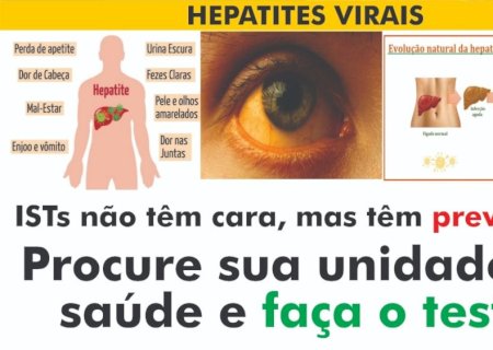 Secretaria de saúde de Ivinhema faz alerta sobre Hepatites Virais
