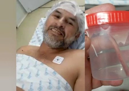 Pescador passa por grande aflição após ferrão de peixe atravessar o braço