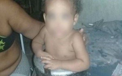 Bebê de um ano fica presa em panela de pressão