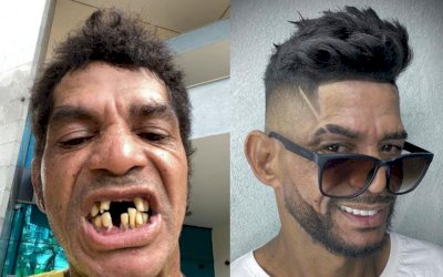 Barbeiro transforma aparência de primo e 'antes e depois' choca a web